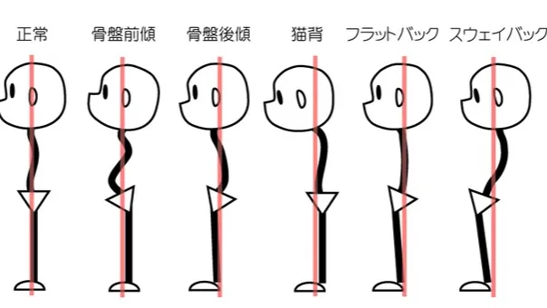体も心もスッキリ！猫背改善のための正しい姿勢を手に入れよう