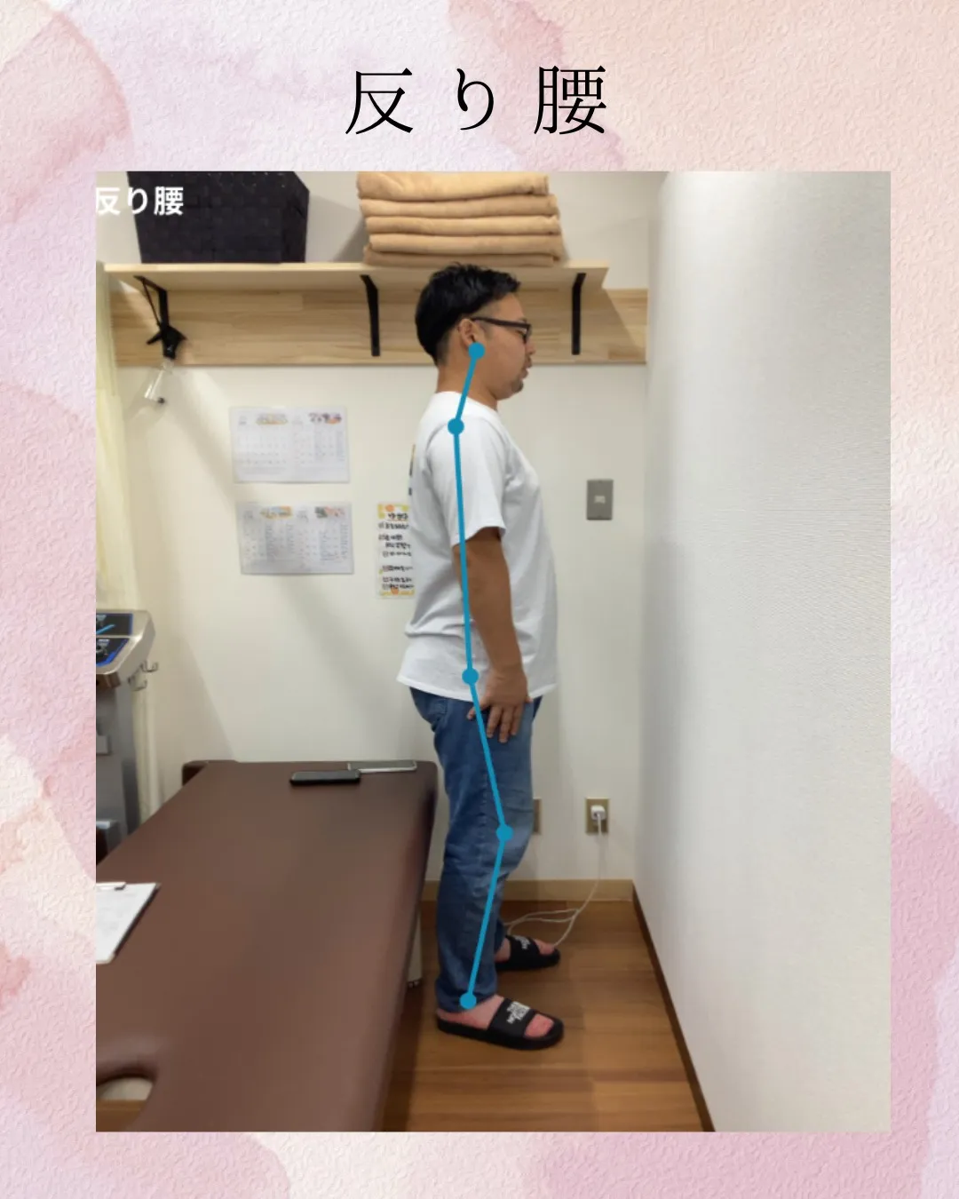 今回は矢状面(横から)の写真です。