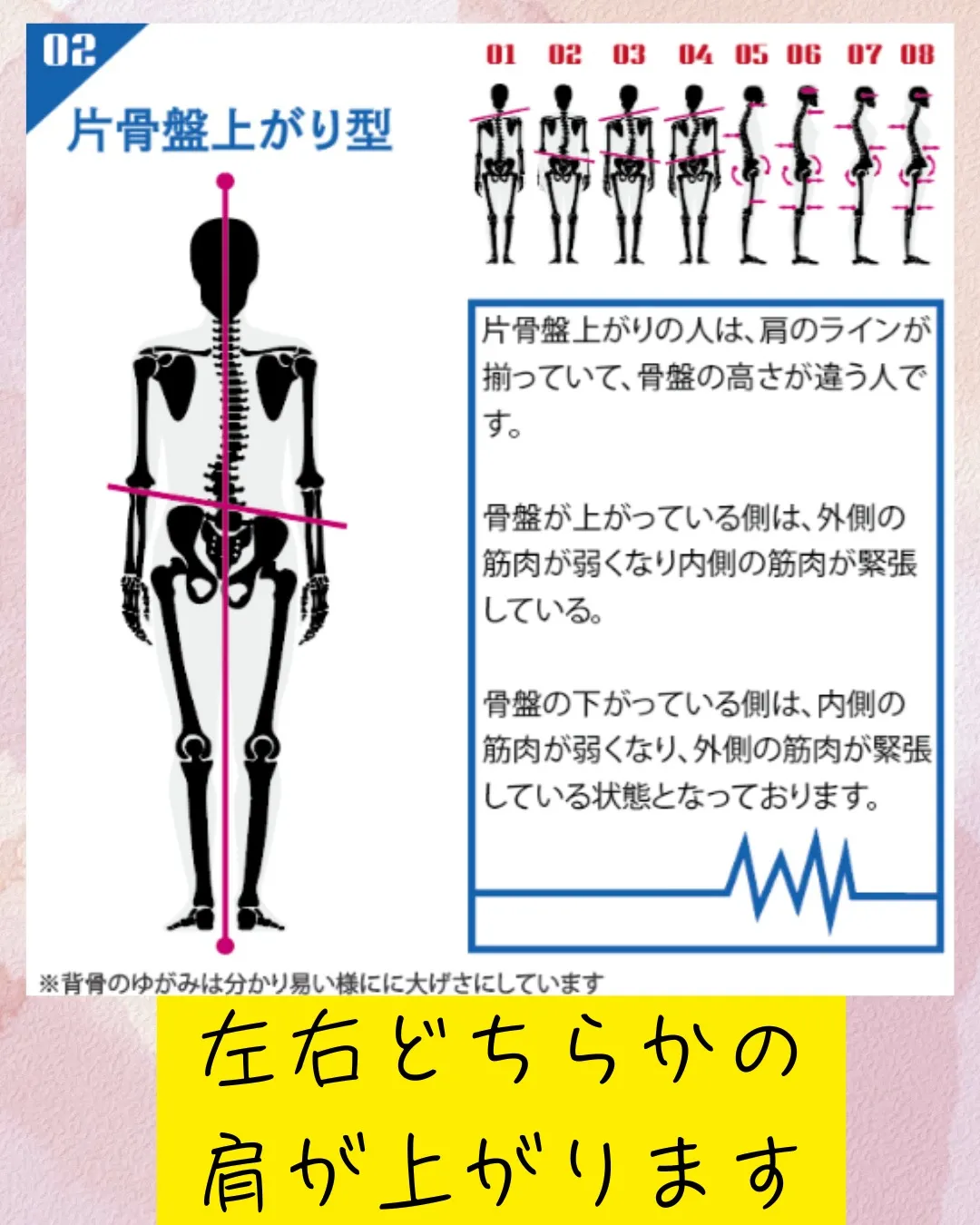 今日は片骨盤上がり。