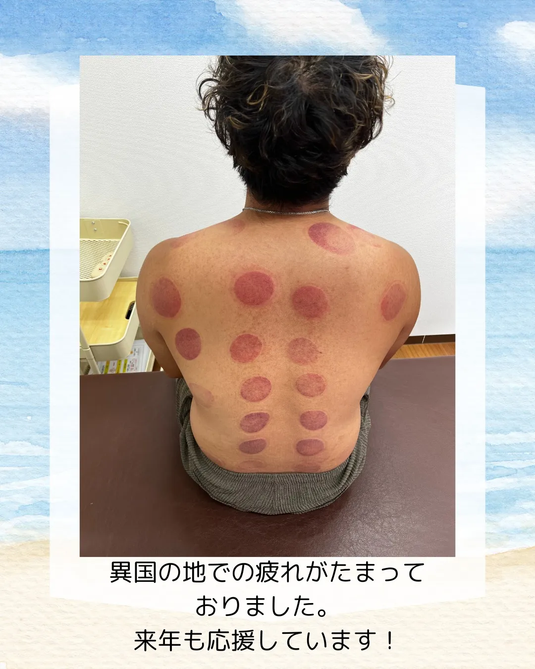 オフのケアをしていた佐藤選手が帰国し早速来院してくださいまし...