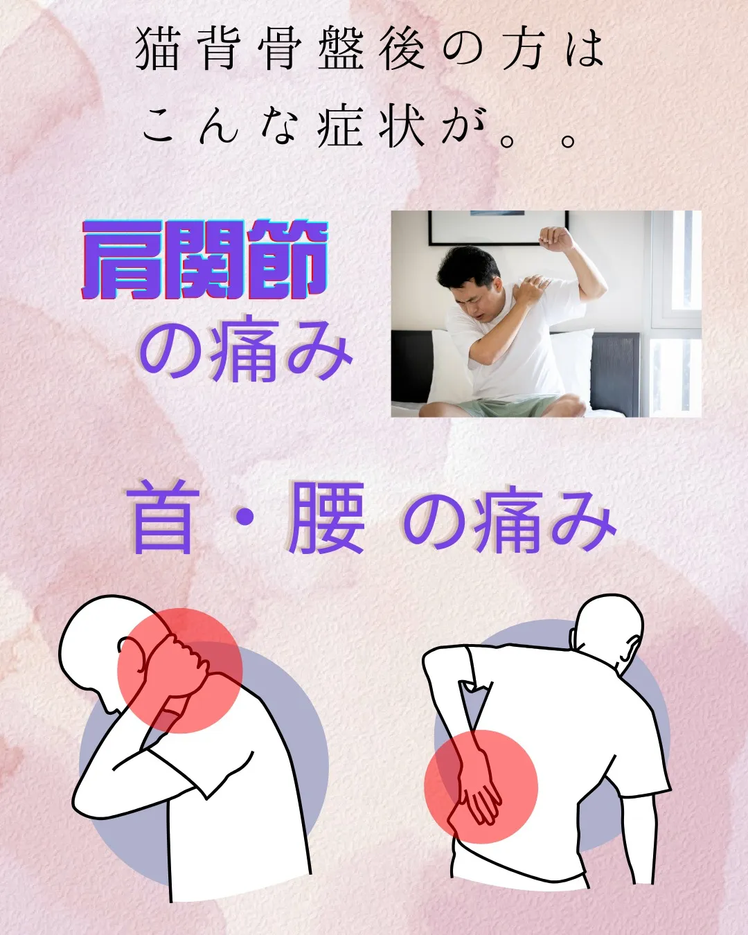 今日は8つあるうちの6つ目、猫背骨盤後型。