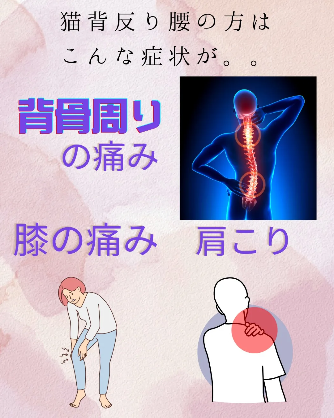 今日は8分類最後の猫背反り腰型。