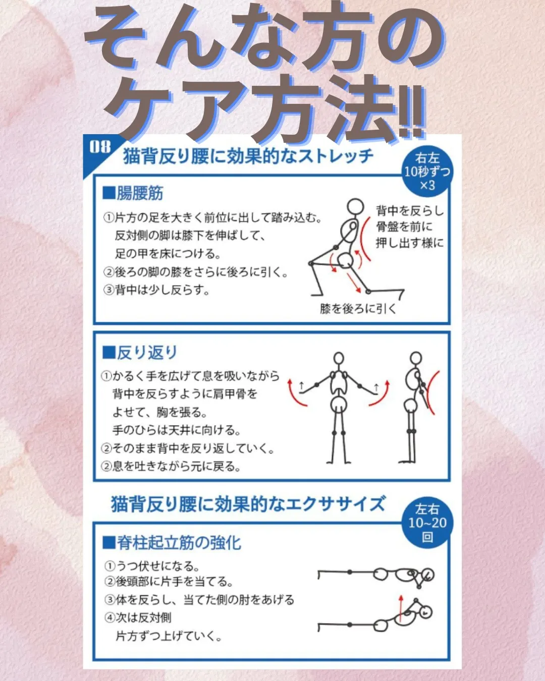 今日は8分類最後の猫背反り腰型。