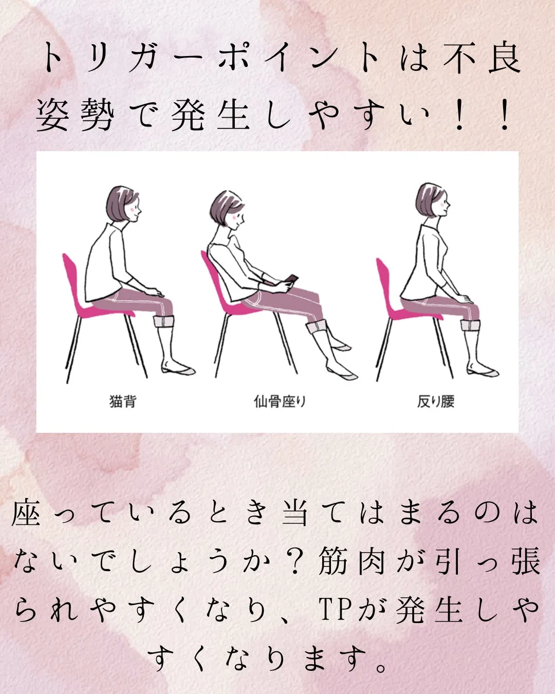 当院でおこなっている施術、トリガーポイント療法。